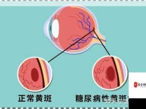 颈部黄斑警示：警惕四种潜在健康隐患