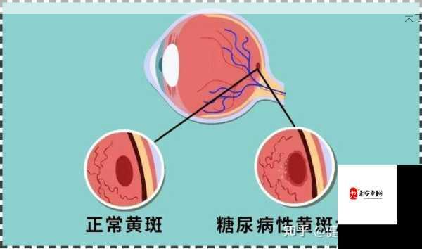 颈部黄斑警示：警惕四种潜在健康隐患